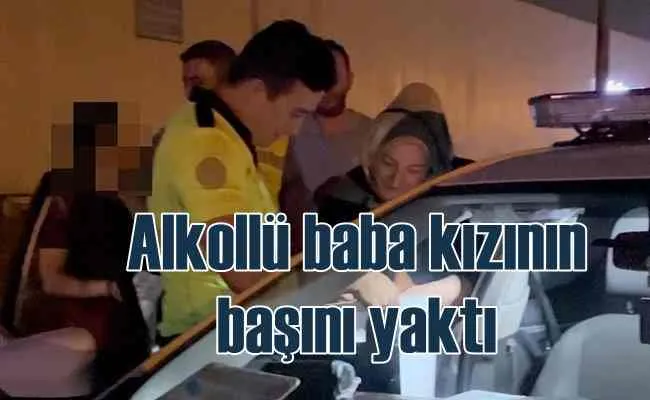 Alkollü baba, ehliyetsiz kızının başını yaktı